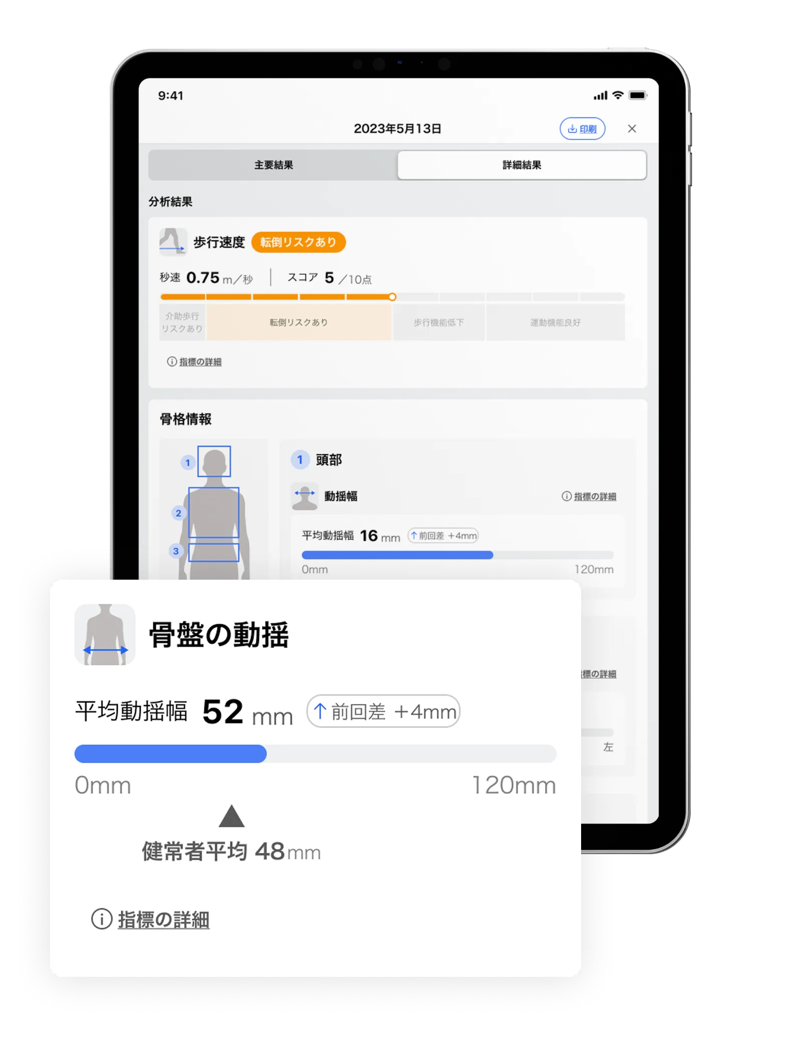 歩行分析の可視化画面