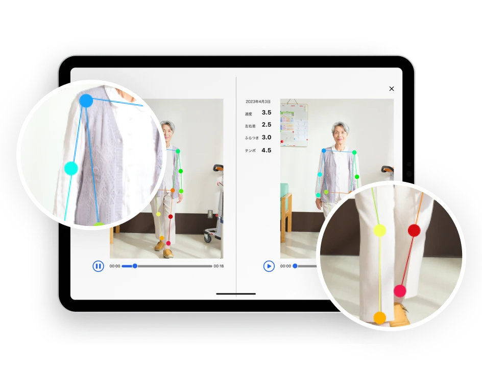 video-comparison アイコン